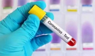 अब घरमै बसेर आफैंले कोरोना जाँच गर्न सकिने, ३० मिनेटमै नतिजा