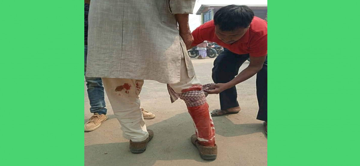 सरकारी कार्यालयममै शक्तिशाली बम बिष्फोट, गम्भीर तीनलाई काठमाडौं ल्याइदै 