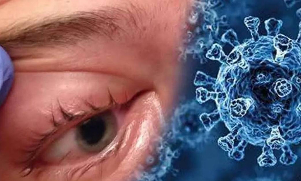 के हो कालो ढुसी ? यस्तो छ यसका लक्षण र रोकथामका उपायहरु