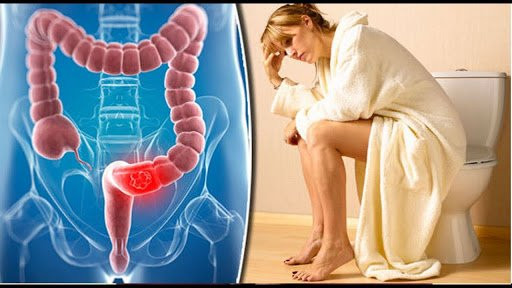 के कारणले हुन्छ पायल्स ? यस्ता छन् निको पार्ने घरेलु उपाय