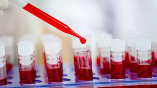 पहिलो पटक एचआईभी संक्रमित महिलाको उपचार सफल
