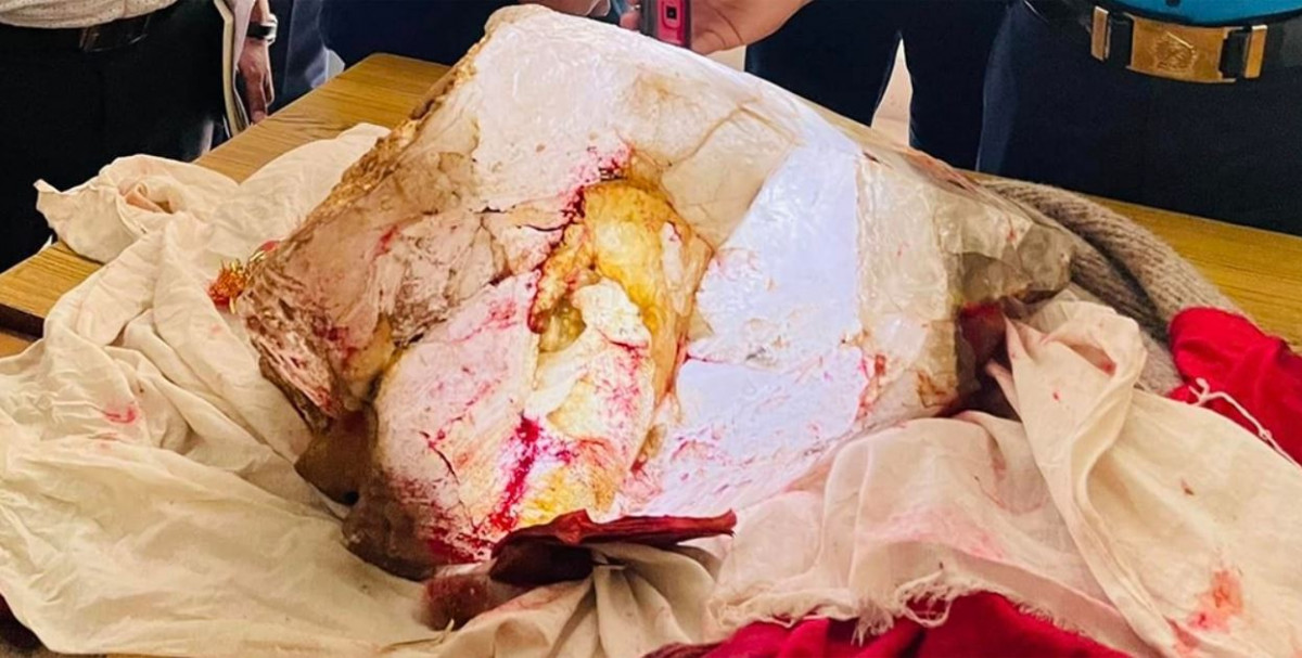 भूगर्भविद्को टोली विशेष सुरक्षासहित गोरखामा, टल्कने ढुंगा परीक्षण गर्न