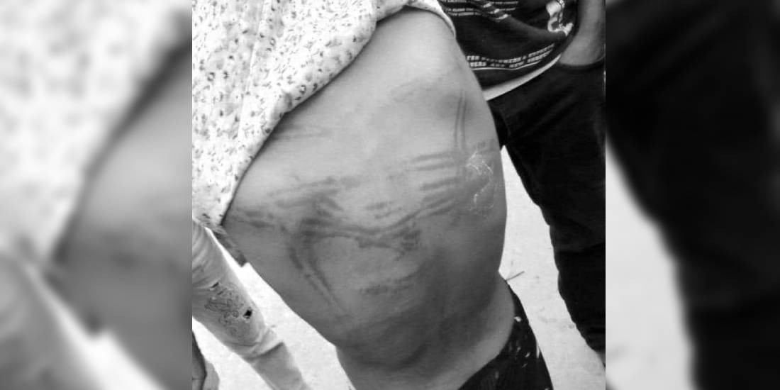 विद्यार्थीलाई कुटपिट गर्ने शिक्षक पक्राउ