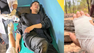 सर्लाहीको लालबन्दी जंगलमा पल शाह गम्भीर घाइते अवस्थामा भेटिए, हातमा गहिरो चोट  
