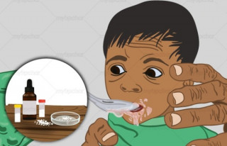 नेपालका बालबालिकालाई तीन वर्षभित्र कुपोषणमुक्त गर्ने अभियान सुरु