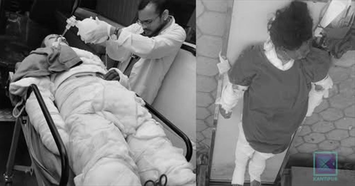 खाना पाकाउने ग्यास विस्फोट भई आगलागी हुँदा  दाजु र  बहिनीको मृत्यु