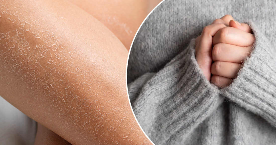 जाडोमा छाला फुस्रो हुन्छ, कसरी मुलायम र चम्किलो राख्ने ?