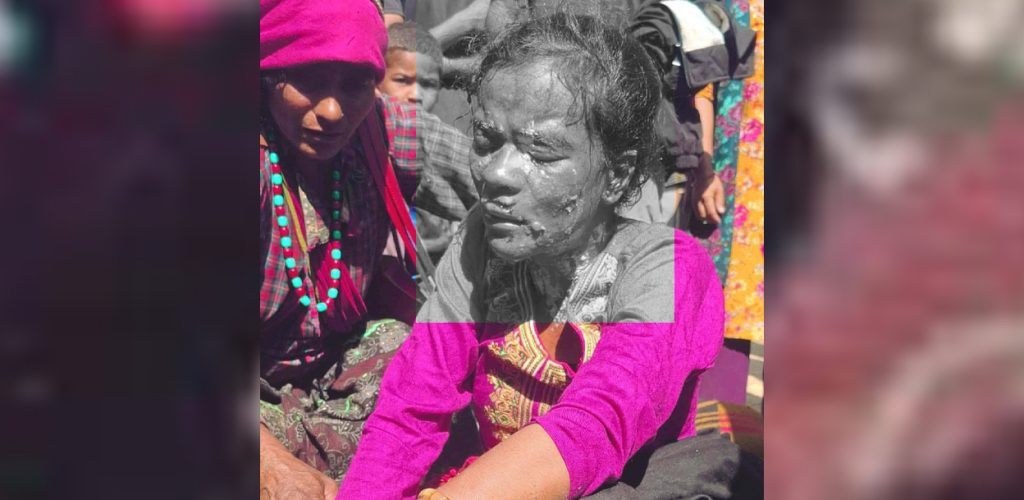 कुकर फड्किँदा एक जना घाइते